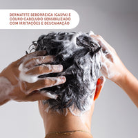 Kit Scalp Care: Anticaspa e Calmante para Dermatite Seborreica