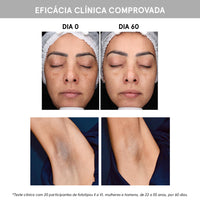 Sérum MelanoControl® Concentrado Clareador Antimanchas